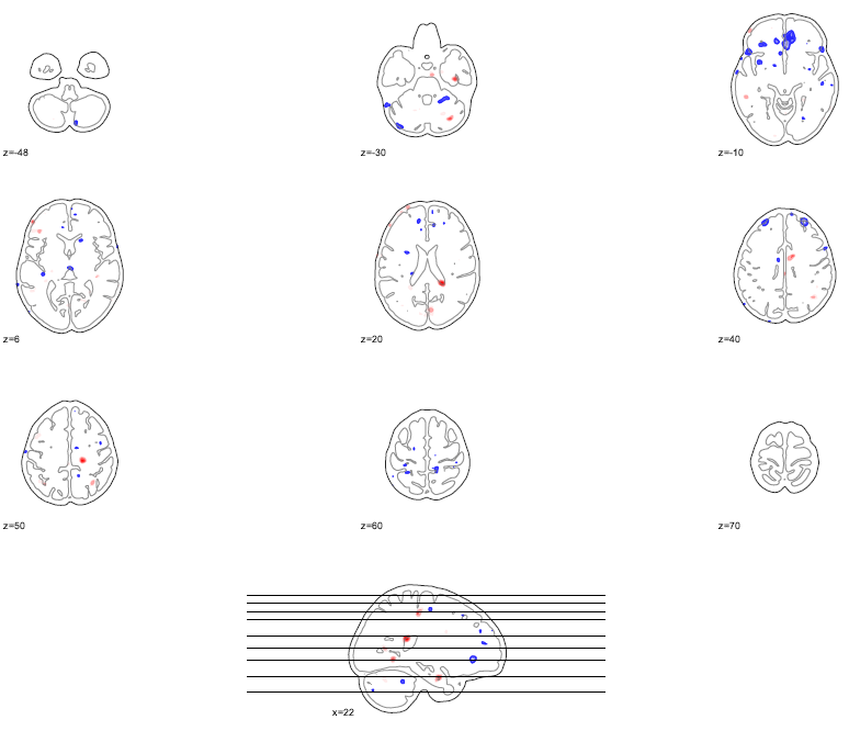 Multiple slices visualisation