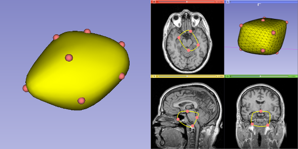 ClosedSurfaceExample